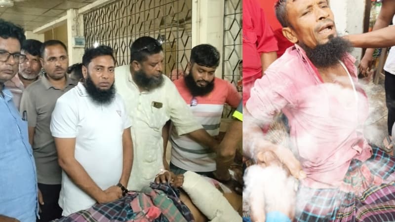 বেনাপোল বন্দরে ভারী যন্ত্রাংশ বুকে পড়ে আশঙ্কাজনক অবস্থায় শ্রমিক